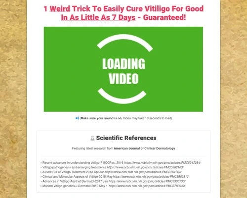vitiligo8 x400 thumb